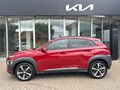 Hyundai Kona 1.0 T-GDI